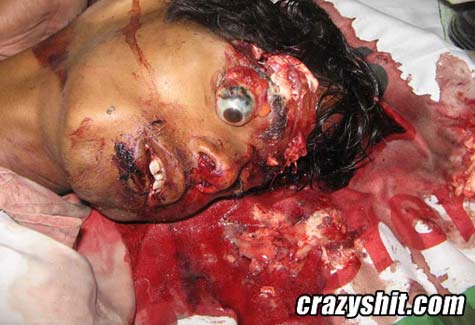 107359d1259594132-eye-popping-headless-body-eye_popped_out.jpg