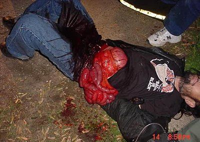 idiot-high-meth-starts-cut-himself-pulling-his-intestines-out-7.jpg