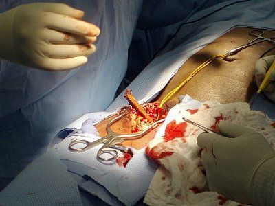 groin-impalement-stick-young-male-groin-impalement-stick-young-male.jpg