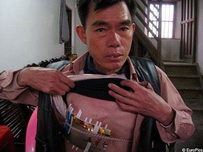 man-visible-heart-surgeryep_450x337.jpg