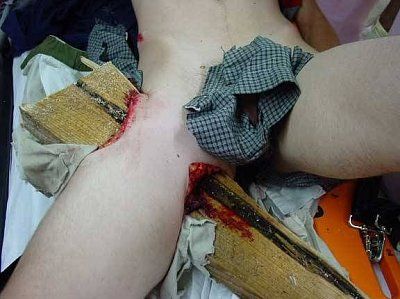teen-impaled-wood-wood03.jpg