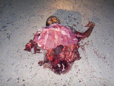mangled-iraqi-man-iraq-war-image-dead-iraq.jpg