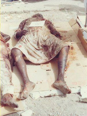 iraq-war-images-gory-iraq6.jpg