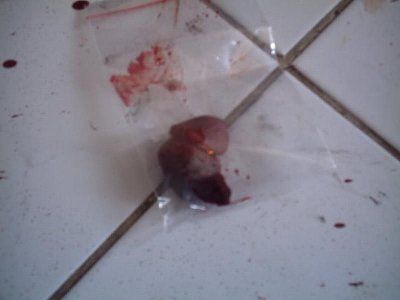 murdered-cock-cut-off-cock-gone-murder-1.jpg