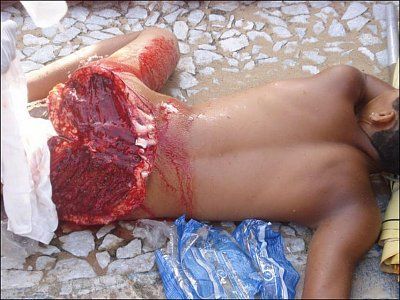 shark-took-bite-out-guys-ass-shark-ate-butt.jpg