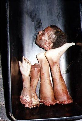 dismembered-limbs-extreme.jpg