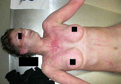 whats-all-red-marks-6.jpg