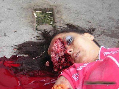 female-face-trauma-.jpg