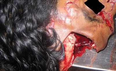 head-crushed-car-wheel-1.jpg