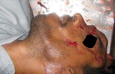 head-crushed-car-wheel-2.jpg