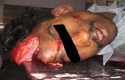 head-crushed-car-wheel-5.jpg