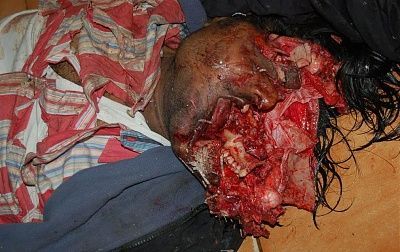 skull-crushed-2.jpg