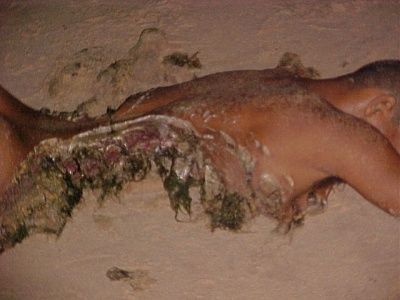 shark-attack-victim-zzzzzzzzzzshark82ak.jpg
