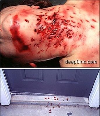 stabbed-neck-130-times-70.jpg