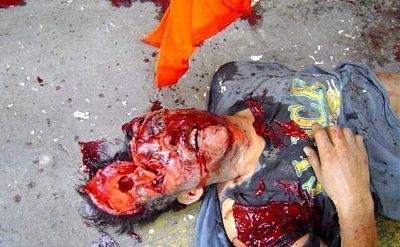 air-compressor-explodes-mans-head-1.jpg