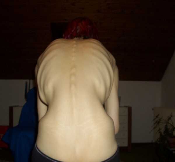 Gory Pictures and Video