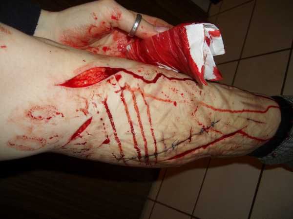 Gory Pictures and Video