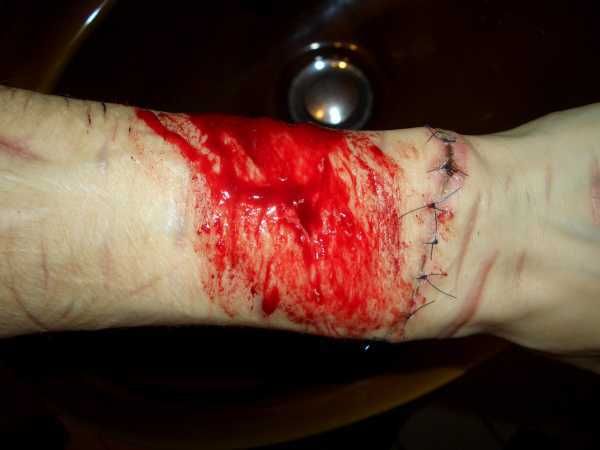 Gory Pictures and Video