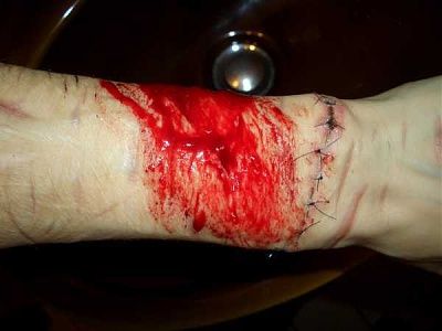 some-emo-girl-needs-serious-help-emo_girl_cuts_herself_picture-13.jpg