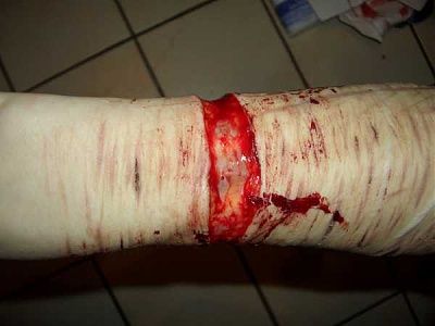 some-emo-girl-needs-serious-help-emo_girl_cuts_herself_picture-16.jpg