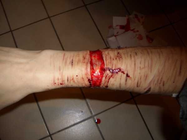 Gory Pictures and Video