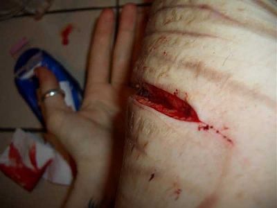 some-emo-girl-needs-serious-help-emo_girl_cuts_herself_picture-23.jpg