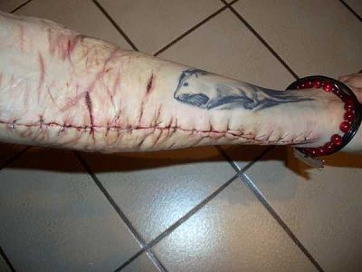 some-emo-girl-needs-serious-help-emo_girl_cuts_herself_picture-25.jpg