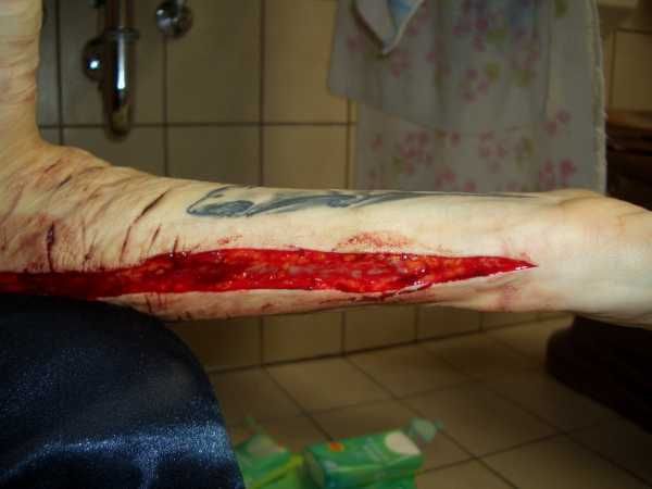 Gory Pictures and Video