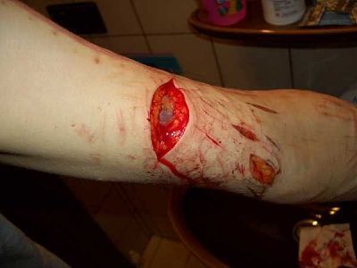 some-emo-girl-needs-serious-help-emo_girl_cuts_herself_picture-41.jpg