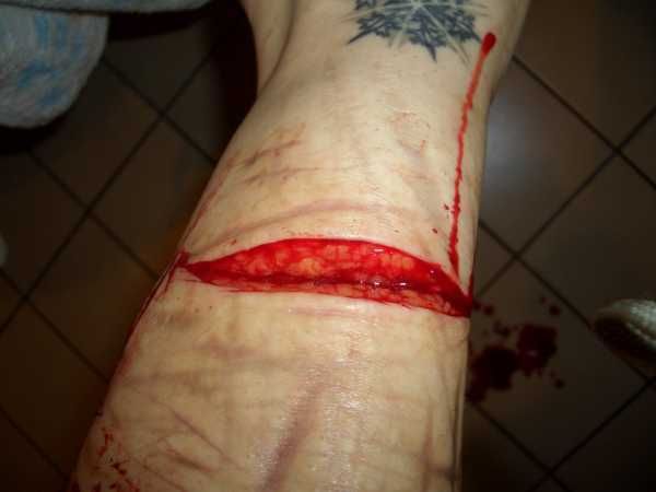 Gory Pictures and Video