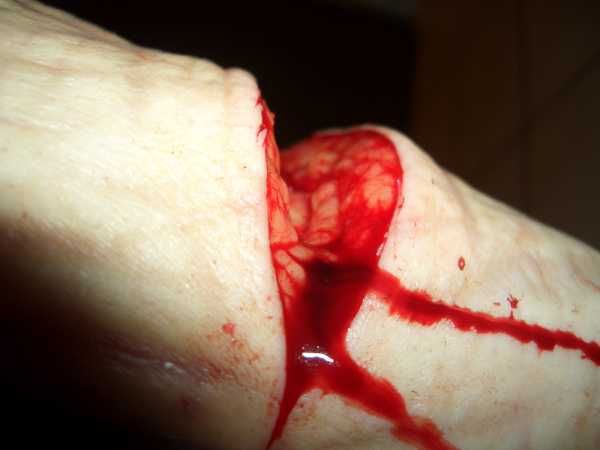 Gory Pictures and Video