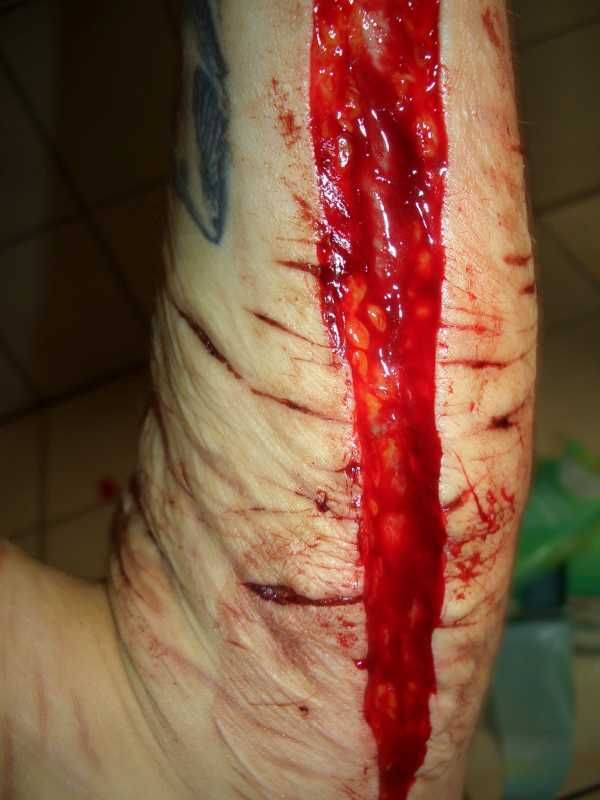 Gory Pictures and Video