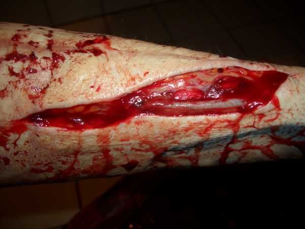 Gory Pictures and Video