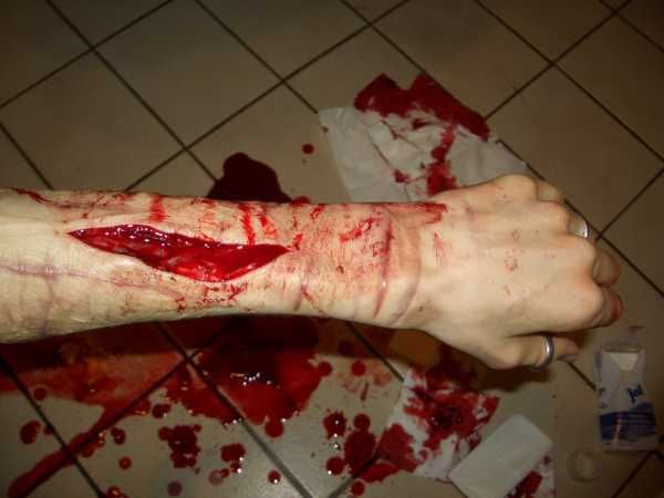Gory Pictures and Video