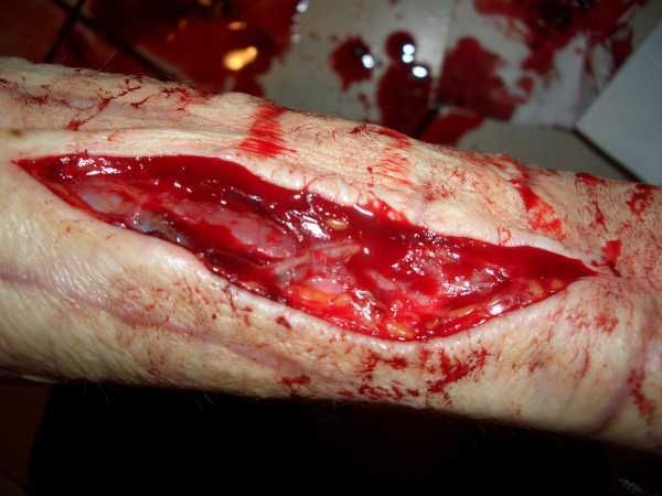 Gory Pictures and Video