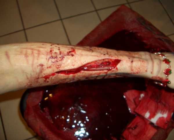 Gory Pictures and Video