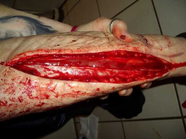 Gory Pictures and Video