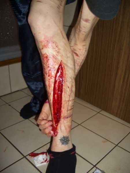 Gory Pictures and Video