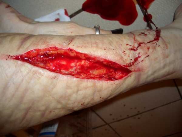 Gory Pictures and Video