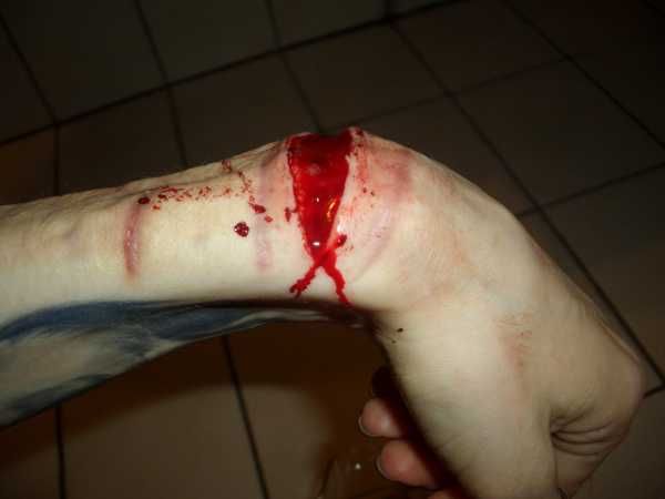 Gory Pictures and Video