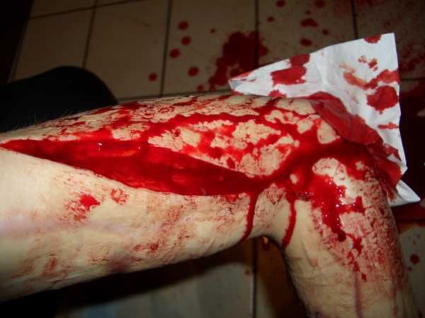 Gory Pictures and Video