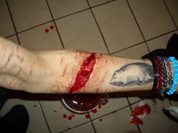 Gory Pictures and Video