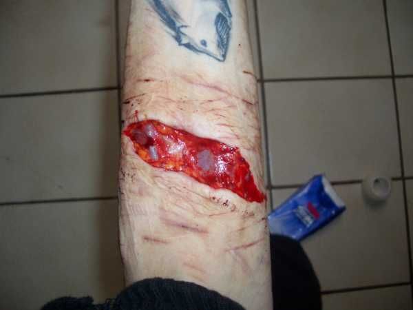 Gory Pictures and Video