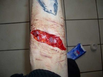 some-emo-girl-needs-serious-help-emo_girl_cuts_herself_picture-105.jpg
