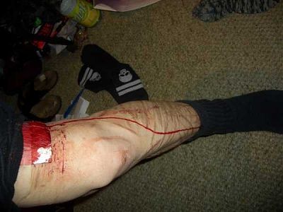 some-emo-girl-needs-serious-help-emo_girl_cuts_herself_picture-115.jpg