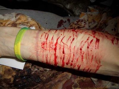 some-emo-girl-needs-serious-help-emo_girl_cuts_herself_picture-119.jpg