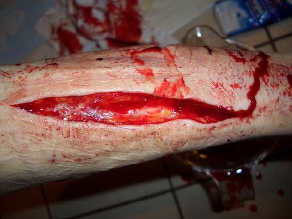 Gory Pictures and Video