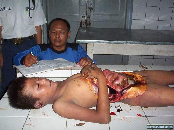 http://www.documentingreality.com/forum/attachments/f10/263314d1302582670-dead-kid-kid.jpg http://www.documentingreality.com/forum/attachments/f10/263314d1302582670-dead-kid-kid.jpg