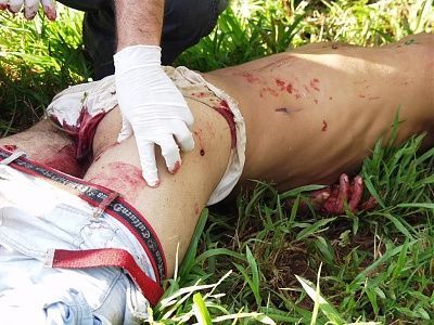 man-found-dead-grass-somethings-missing3.jpg