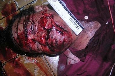 man-found-dead-slashed-throat-throat2.jpg